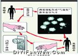 強烈提醒：吃生冷海鮮易感染“諾瓦克”病毒